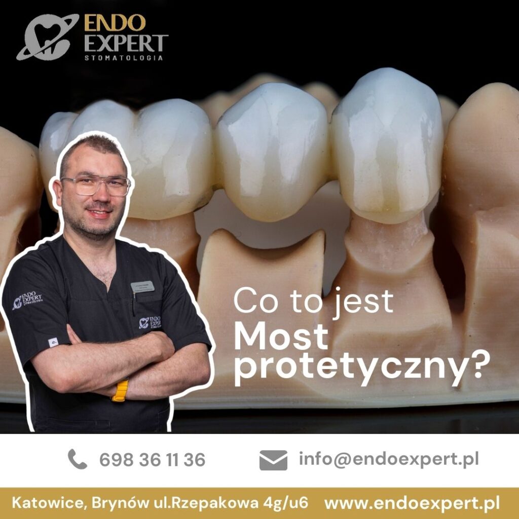Most protetyczny Endoexpert Katowice Brynów