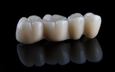 Co zamiast implantu?