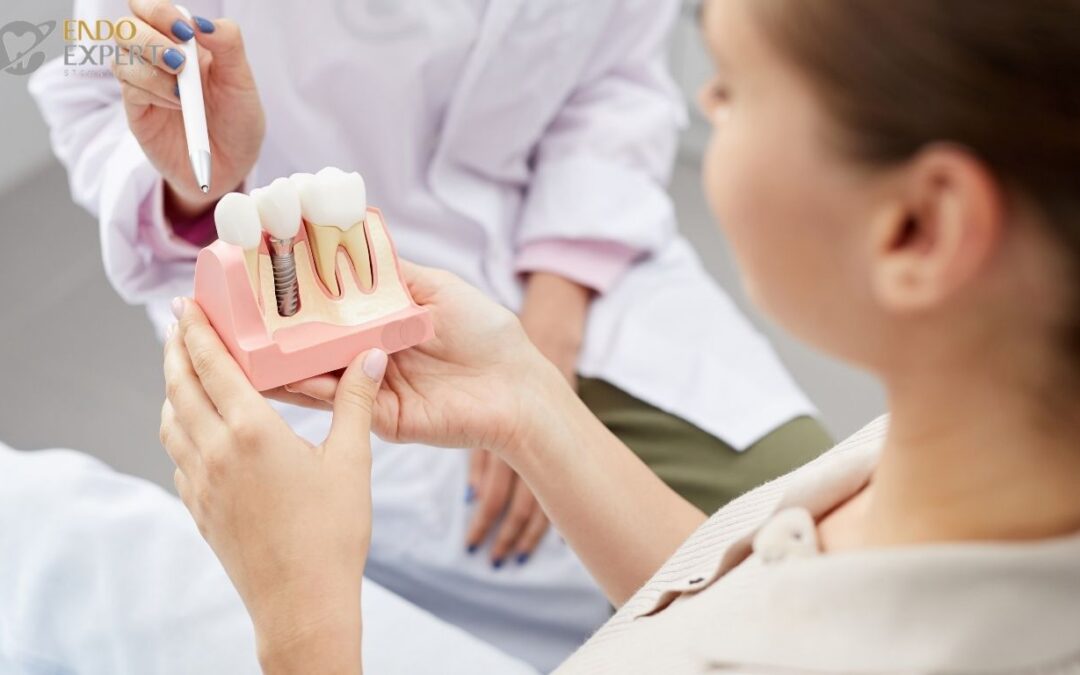 Higiena po wszczepieniu implantów – EndoExpert Katowice