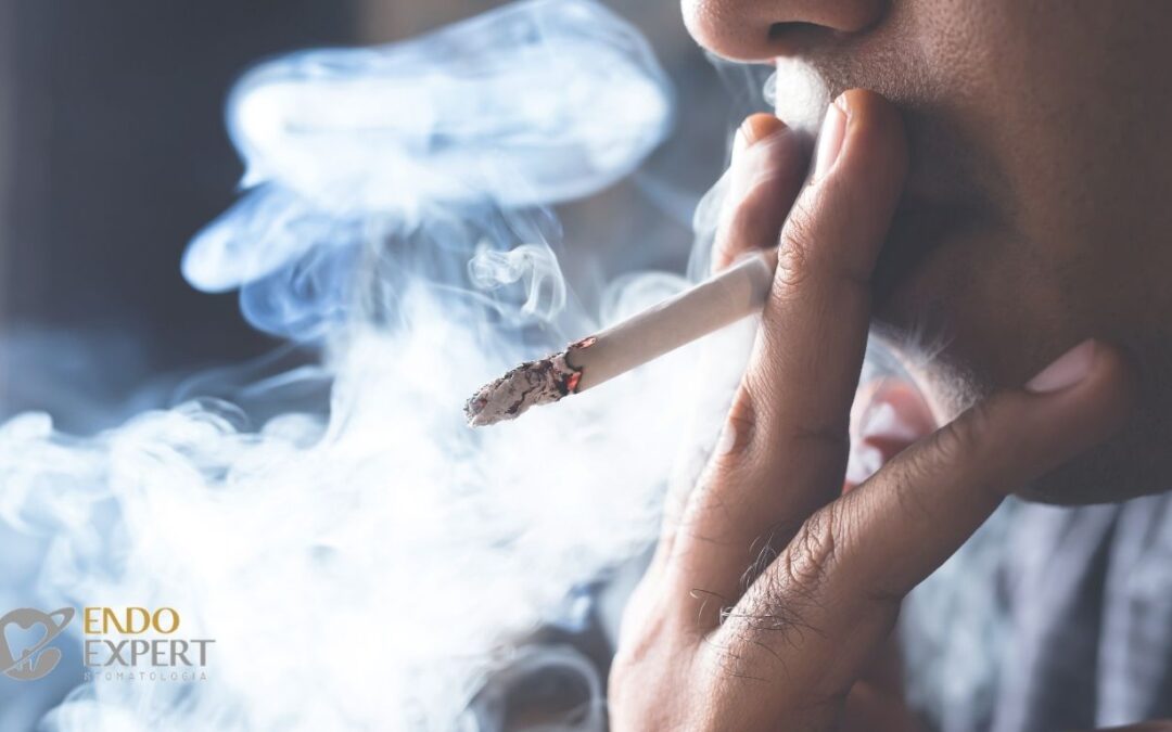 Implanty zębowe a palenie papierosów – jak nałóg wpływa na gojenie i ryzyko odrzucenia?